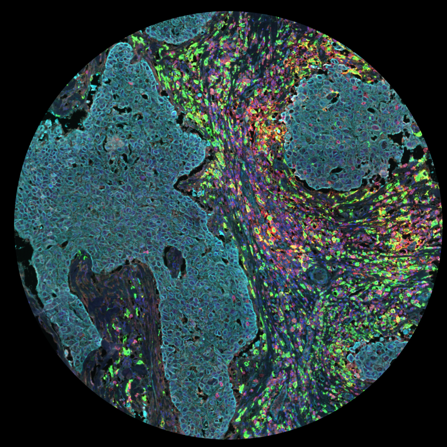 Multiplex IHC ImmunoMapping