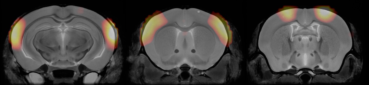 MRI_Kuan_Lab_MouseICA