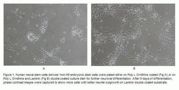 Picture of Laminin Mouse Protein 1mg