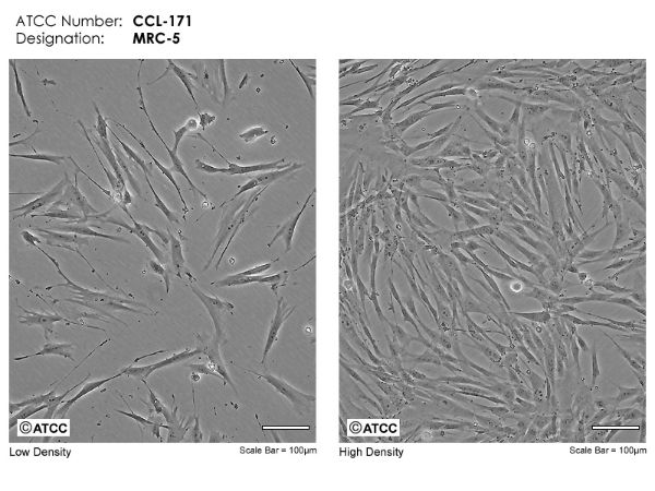 Picture of MRC-5 cell line