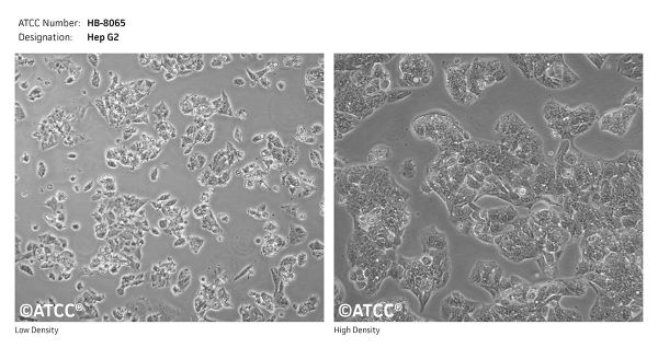 Picture of Hep G2 cell line