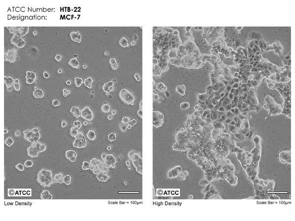 Picture of MCF-7 cell line