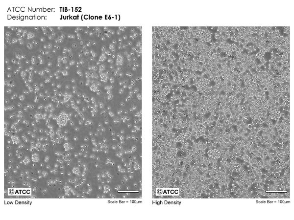 Picture of JURKAT, CLONE E6-1 cell line