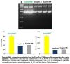 Picture of ZymoPURE Plasmid MniPrep Kit, 100 Preps